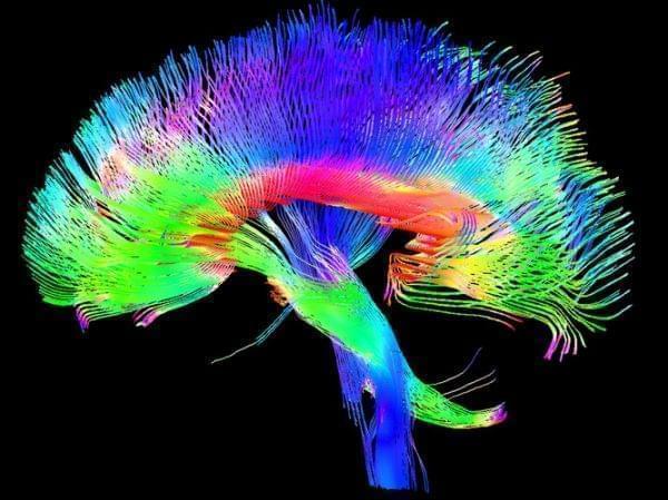 A colored 3-D MRI scan of the brain's white matter pathways traces connections between cells in the cerebrum and the brainstem.