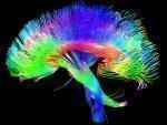 A colored 3-D MRI scan of the brain's white matter pathways traces connections between cells in the cerebrum and the brainstem.