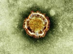 The coronavirus emerged in 2012.