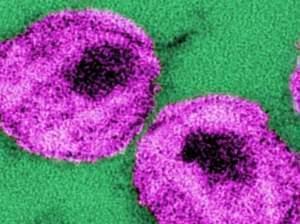These HIV viruses even look a little like bull's-eyes.