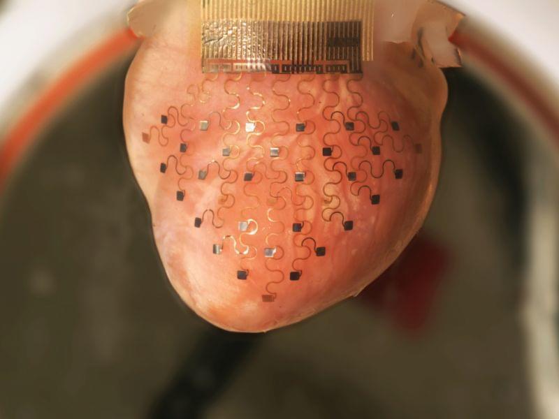 This photo shows the new cardiac device ― a thin, elastic membrane ― fitted over a rabbit's heart. The membrane is imprinted with a network of electrodes that can monitor cardiac function and deliver an electrical impulse to correct an erratic h