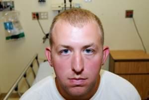 Photo of Darren Wilson during his medical examination after he fatally shot Michael Brown