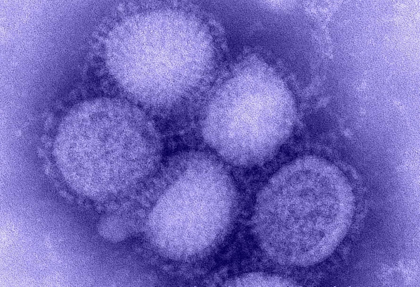Flu Cases Are Scarce In Illinois This Year So Far News Local State 