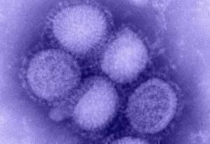 Electron microscope image of the H1N1 influenza virus.