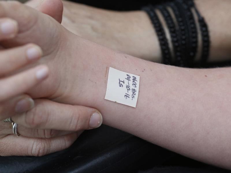 A medical marijuana patch on a patient's arm. 