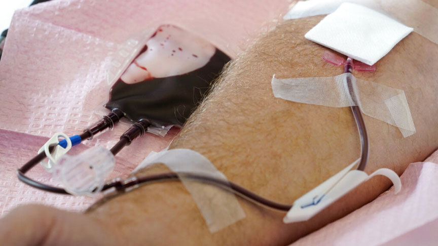 Tubes direct blood from a donor into a bag in Davenport, Iowa, on Friday, Nov. 11, 2022. The U.S. is moving to ease restrictions on blood donations from gay and bisexual men and other groups that traditionally face higher risks of HIV. TThe Food and Drug Administration on Friday, Jan. 27, 2023, announced draft guidelines that would do away with the current three-month abstinence requirement for donations from men who have sex with men.